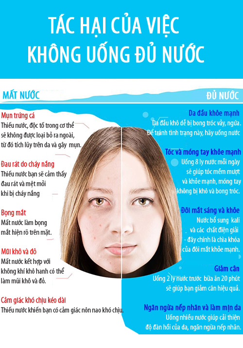 Lý do bạn cần uống đủ nước mỗi ngày