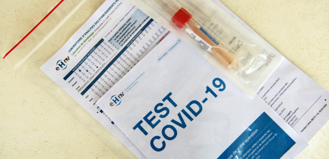 Triệt phá xưởng sản xuất bất hợp pháp hệ thống thử test Covid-19 trên địa bàn tỉnh Kharcov